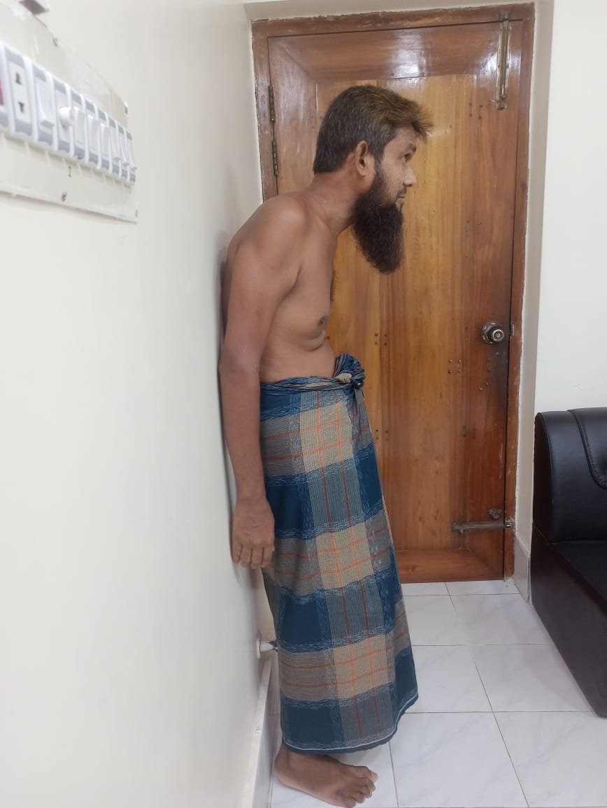Ankylosing Spondylitys